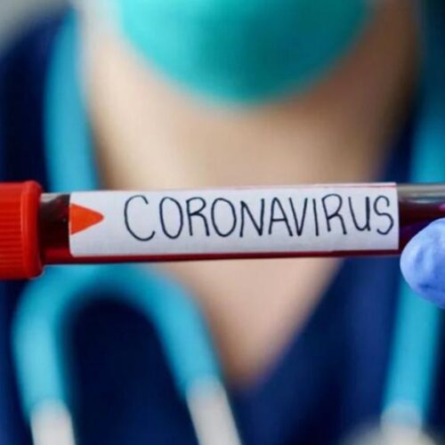 Әлемде коронавирус жұқтырғандардың жалпы саны 615,7 млн асты