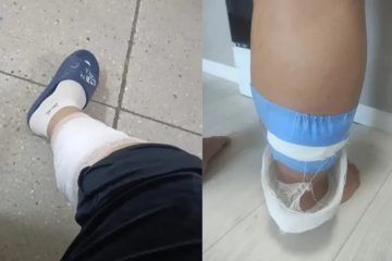 Көкшетауда жүкті әйелді бір топ құтырған ит қауып алған
